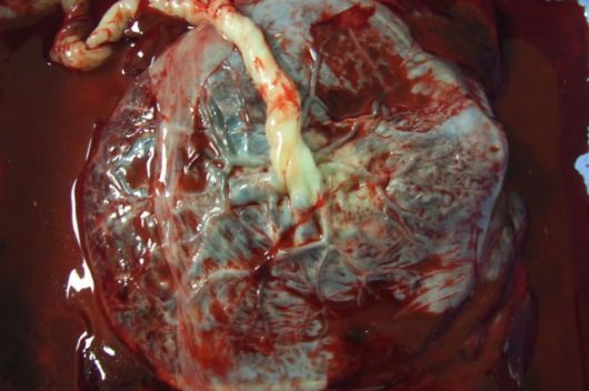 De menselijke placenta