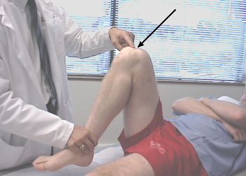 Pijn in de knie tijdens flexie is de meest voorkomende reden waarom mensen traumadokters bezoeken. 